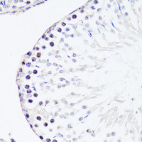 Immunohistochemistry of paraffin-embedded Rat testis using FGF12 Polyclonal Antibody at dilution of 1:150 (40x lens) .