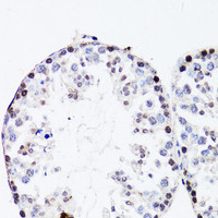 Immunohistochemistry of paraffin-embedded Mouse testis using FGF12 Polyclonal Antibody at dilution of 1:150 (40x lens) .