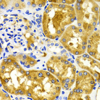 Immunohistochemistry of paraffin-embedded Human kidney using CDK20 Polyclonal Antibody at dilution of 1:100 (40x lens) .