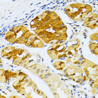 Immunohistochemistry of paraffin-embedded Human stomach using DBH Polyclonal Antibody at dilution of 1:100 (40x lens) .