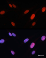 Immunofluorescence analysis of U-2 OS cells using FOSL2 Polyclonal Antibody at dilution of 1:100. Blue: DAPI for nuclear staining.