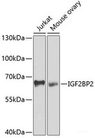 Western blot analysis of extracts of various cell lines using IGF2BP2 Polyclonal Antibody at dilution of 1:1000.