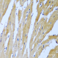 Immunohistochemistry of paraffin-embedded Rat heart using IGF2BP3 Polyclonal Antibody at dilution of 1:100 (40x lens) .
