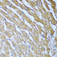 Immunohistochemistry of paraffin-embedded Human liver using IGF2BP3 Polyclonal Antibody at dilution of 1:100 (40x lens) .