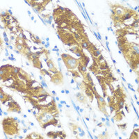Immunohistochemistry of paraffin-embedded Human stomach using NME3 Polyclonal Antibody at dilution of 1:100 (40x lens) .