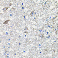 Immunohistochemistry of paraffin-embedded Rat brain using CDH23 Polyclonal Antibody at dilution of 1:100 (40x lens) .