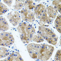 Immunohistochemistry of paraffin-embedded Human stomach using CDH23 Polyclonal Antibody at dilution of 1:100 (40x lens) .