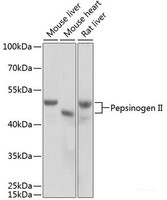 Western blot analysis of extracts of various cell lines using Pepsinogen II Polyclonal Antibody at dilution of 1:1000.