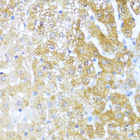 Immunohistochemistry of paraffin-embedded Rat liver using SERPINA3 Polyclonal Antibody at dilution of 1:100 (40x lens) .