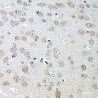 Immunohistochemistry of paraffin-embedded Mouse brain using ACHE Polyclonal Antibody at dilution of 1:100 (40x lens) .