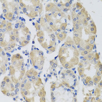 Immunohistochemistry of paraffin-embedded Human stomach using GPT Polyclonal Antibody at dilution of 1:100 (40x lens) .
