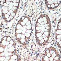 Immunohistochemistry of paraffin-embedded Human colon using APC Polyclonal Antibody at dilution of 1:200 (40x lens) .