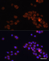 Immunofluorescence analysis of HT-29 cells using APC Polyclonal Antibody at dilution of 1:100. Blue: DAPI for nuclear staining.