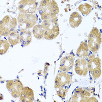 Immunohistochemistry of paraffin-embedded Human stomach using RHOB Polyclonal Antibody at dilution of 1:100 (40x lens) .