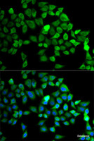 Immunofluorescence analysis of MCF-7 cells using CUL2 Polyclonal Antibody