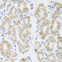 Immunohistochemistry of paraffin-embedded Human stomach using MIP Polyclonal Antibody at dilution of 1:100 (40x lens) .