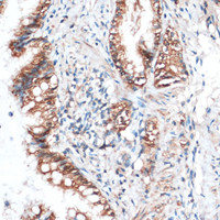 Immunohistochemistry of paraffin-embedded Rat lung using Aquaporin 4 Polyclonal Antibody at dilution of 1:100 (40x lens) .