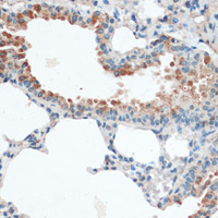 Immunohistochemistry of paraffin-embedded Mouse lung using Aquaporin 4 Polyclonal Antibody at dilution of 1:100 (40x lens) .