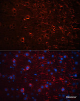 Immunofluorescence analysis of Mouse brain using Aquaporin 4 Polyclonal Antibody at dilution of 1:100 (40x lens) . Blue: DAPI for nuclear staining.