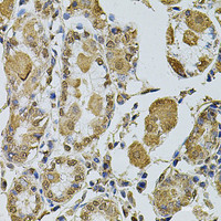 Immunohistochemistry of paraffin-embedded Human stomach using Cyclin A2 Polyclonal Antibody at dilution of 1:100 (40x lens) .