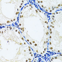 Immunohistochemistry of paraffin-embedded Rat testis using DDB1 Polyclonal Antibody at dilution of 1:100 (40x lens) .