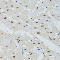 Immunohistochemistry of paraffin-embedded Mouse heart using DDB1 Polyclonal Antibody at dilution of 1:100 (40x lens) .