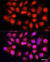 Immunofluorescence analysis of HeLa cells using DDB1 Polyclonal Antibody at dilution of 1:100 (40x lens) . Blue: DAPI for nuclear staining.