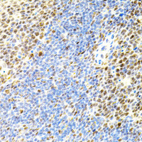 Immunohistochemistry of paraffin-embedded Mouse spleen using EIF4G2 Polyclonal Antibody