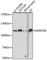 Western blot analysis of extracts of various cell lines using DNMT3B Polyclonal Antibody at dilution of 1:1000.