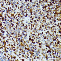 Immunohistochemistry of paraffin-embedded Human appendix using DUT Polyclonal Antibody at dilution of 1:100 (40x lens) .