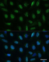 Immunofluorescence analysis of U-2 OS cells using DUT Polyclonal Antibody at dilution of 1:100 (40x lens) . Blue: DAPI for nuclear staining.