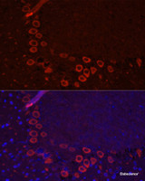 Immunofluorescence analysis of Mouse brain using SLC1A1 Polyclonal Antibody at dilution of 1:100. Blue: DAPI for nuclear staining.