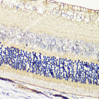 Immunohistochemistry of paraffin-embedded Rat retina using GRK1 Polyclonal Antibody at dilution of 1:200 (40x lens) .
