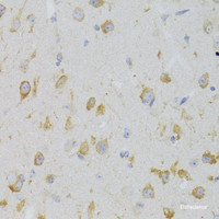 Immunohistochemistry of paraffin-embedded Mouse brain using KISS1R Polyclonal Antibody at dilution of 1:100 (40x lens) .