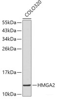 Western blot analysis of extracts of COLO320 cells using HMGA2 Polyclonal Antibody.