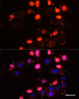 Immunofluorescence analysis of HeLa cells using HMGB2 Polyclonal Antibody at dilution of 1:100. Blue: DAPI for nuclear staining.