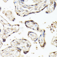 Immunohistochemistry of paraffin-embedded Human placenta using KLF5 Polyclonal Antibody at dilution of 1:100 (40x lens) .