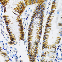 Immunohistochemistry of paraffin-embedded Human stomach using MCT1/SLC16A1 Polyclonal Antibody at dilution of 1:100 (40x lens) .