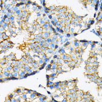 Immunohistochemistry of paraffin-embedded Mouse testis using MCT1/SLC16A1 Polyclonal Antibody at dilution of 1:100 (40x lens) .