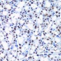 Immunohistochemistry of paraffin-embedded Rat pancreas using MCM4 Polyclonal Antibody at dilution of 1:100 (40x lens) .