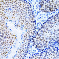 Immunohistochemistry of paraffin-embedded Mouse testis using MCM4 Polyclonal Antibody at dilution of 1:100 (40x lens) .