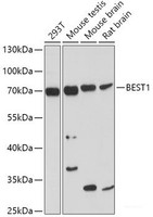 Western blot analysis of extracts of various cell lines using BEST1 Polyclonal Antibody at dilution of 1:1000.