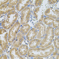 Immunohistochemistry of paraffin-embedded Rat kidney using MMP10 Polyclonal Antibody at dilution of 1:100 (40x lens) .