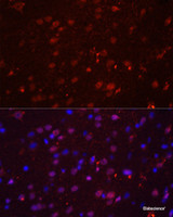 Immunofluorescence analysis of Rat brain using GRIN2B Polyclonal Antibody at dilution of 1:100. Blue: DAPI for nuclear staining.