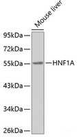 Western blot analysis of extracts of Mouse liver using HNF1A Polyclonal Antibody.