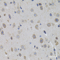 Immunohistochemistry of paraffin-embedded Mouse brain using SUMO3 Polyclonal Antibody