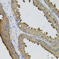 Immunohistochemistry of paraffin-embedded Human prostate using SUMO3 Polyclonal Antibody