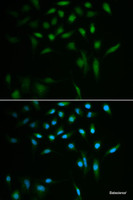 Immunofluorescence analysis of A549 cells using SUMO3 Polyclonal Antibody