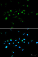 Immunofluorescence analysis of A549 cells using TRIM63 Polyclonal Antibody