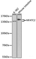 Western blot analysis of extracts of various cell lines using NFATC2 Polyclonal Antibody at dilution of 1:500.